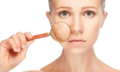 dry skin remedies