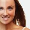 home remedies to remove tan